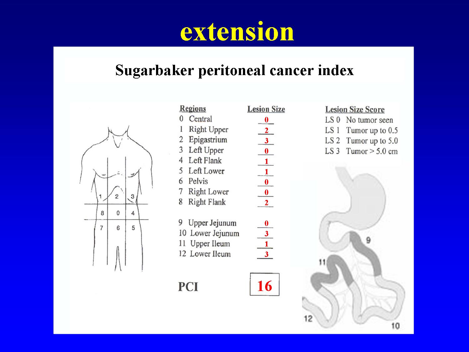 2Indexul Peritoneal Al Cancerului Peritoneal cancer index score, Peritoneal cancer index( pci)