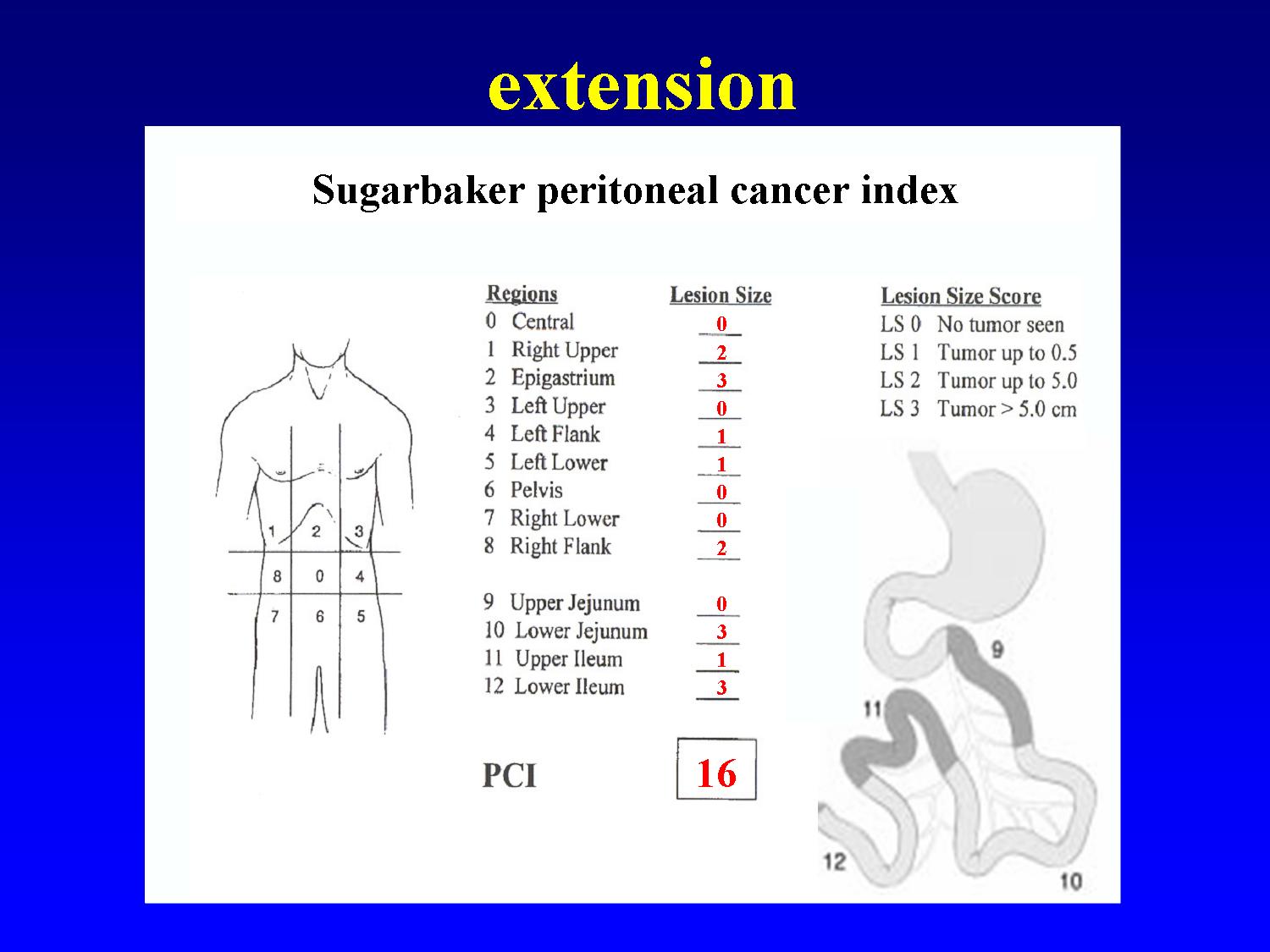 peritoneal cancer return agenți antiparazitari pentru prevenire